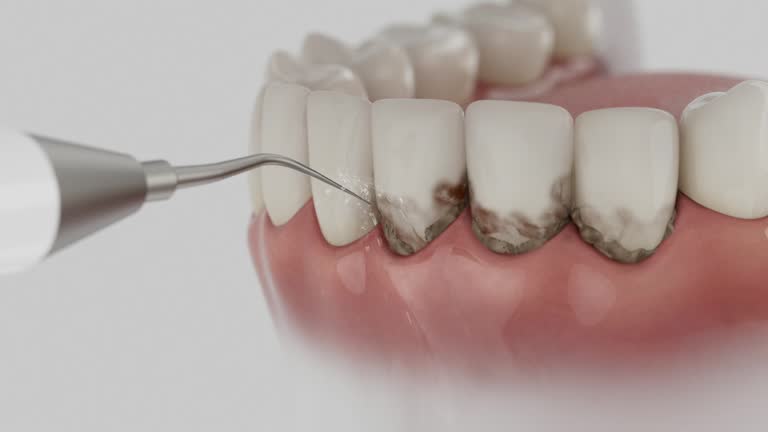 Reliable Teeth Cleaning And Checkup contractor in Russell County County, VA by Dentist Open Now